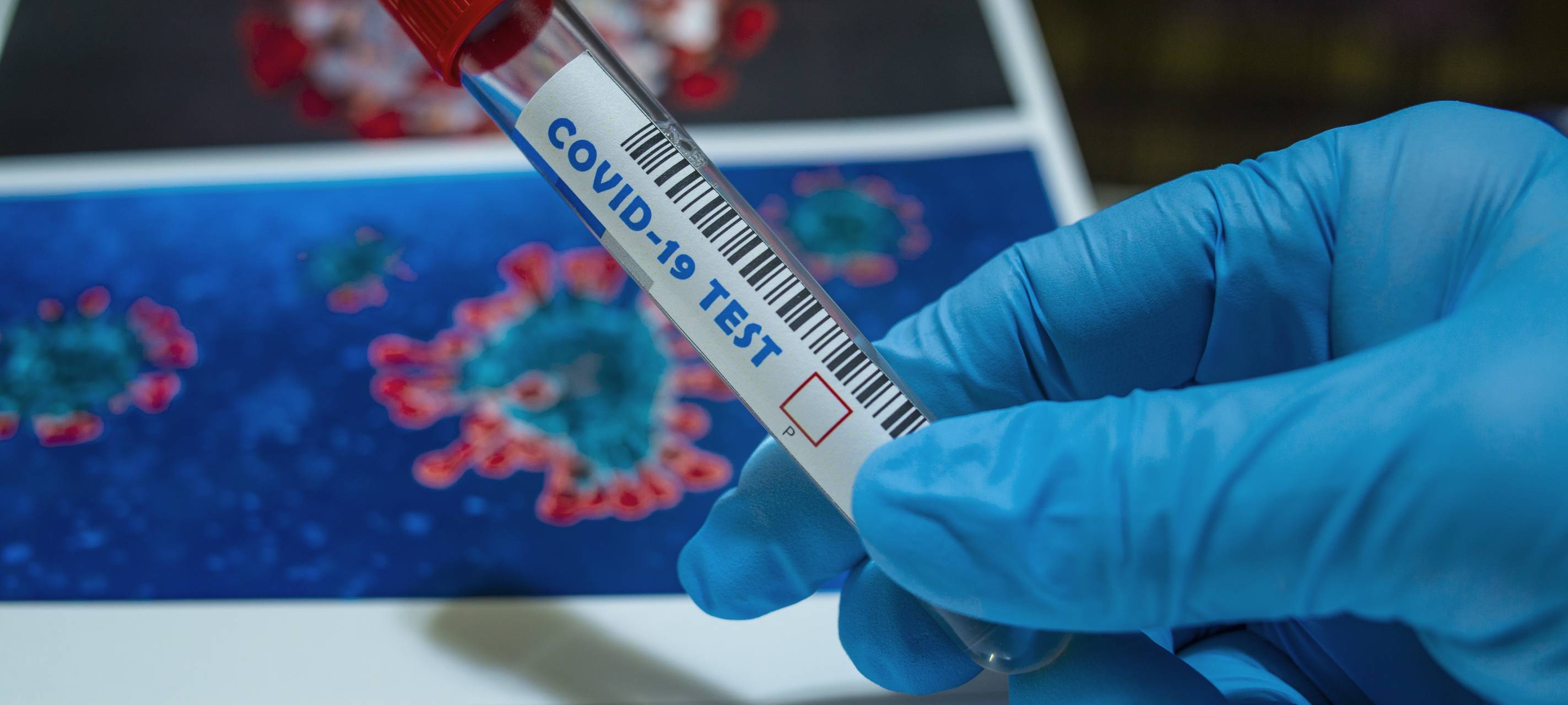 Corona Covid 19 Coronatest
