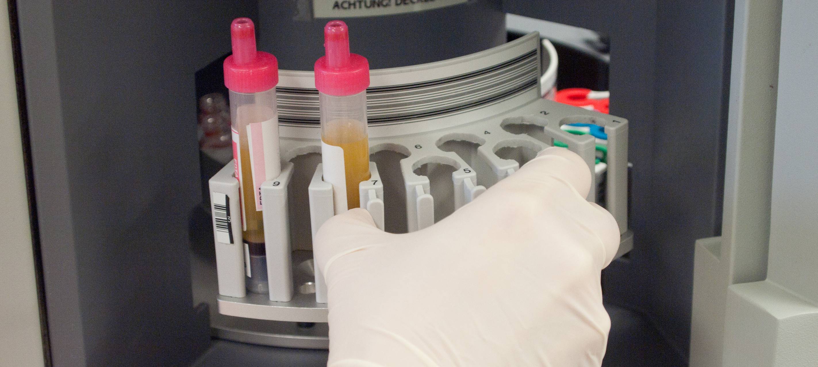 Weiterer Corona-Fall an einer Grundschule