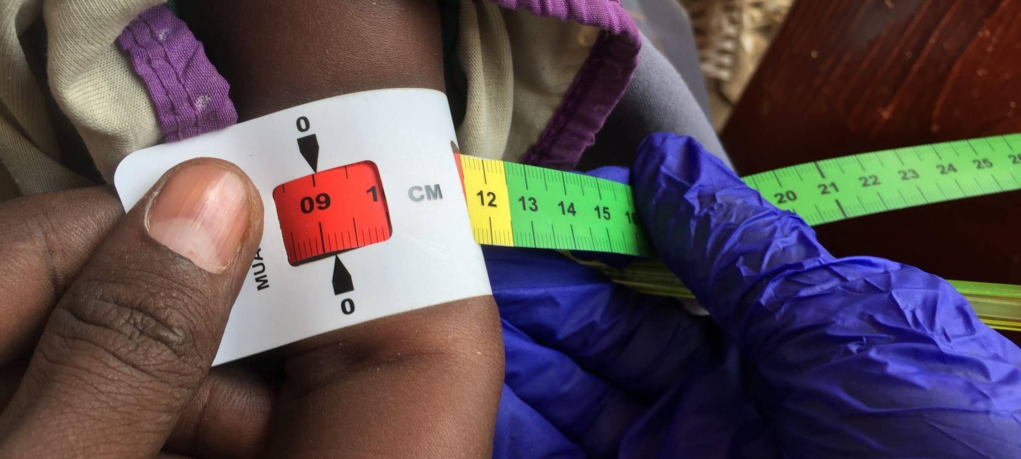 Hunger in Somalia